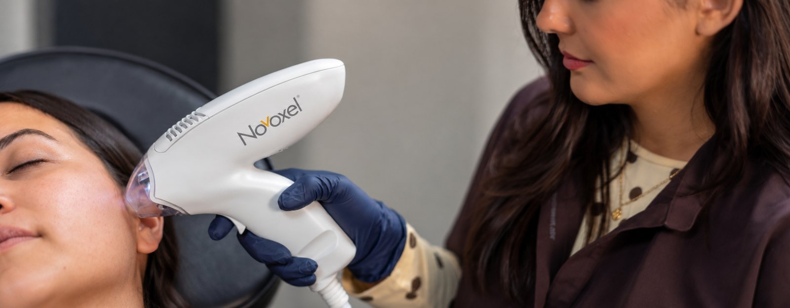 Tixel skin resurfacing treatment at Nurse Laura Aesthetics
